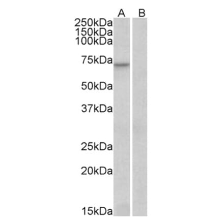 Western Blot - Anti-FOXO3A Antibody (A83729) - Antibodies.com