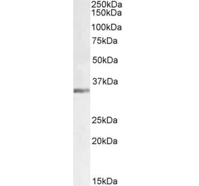 Western Blot - Anti-LDH-C Antibody (A83731) - Antibodies.com