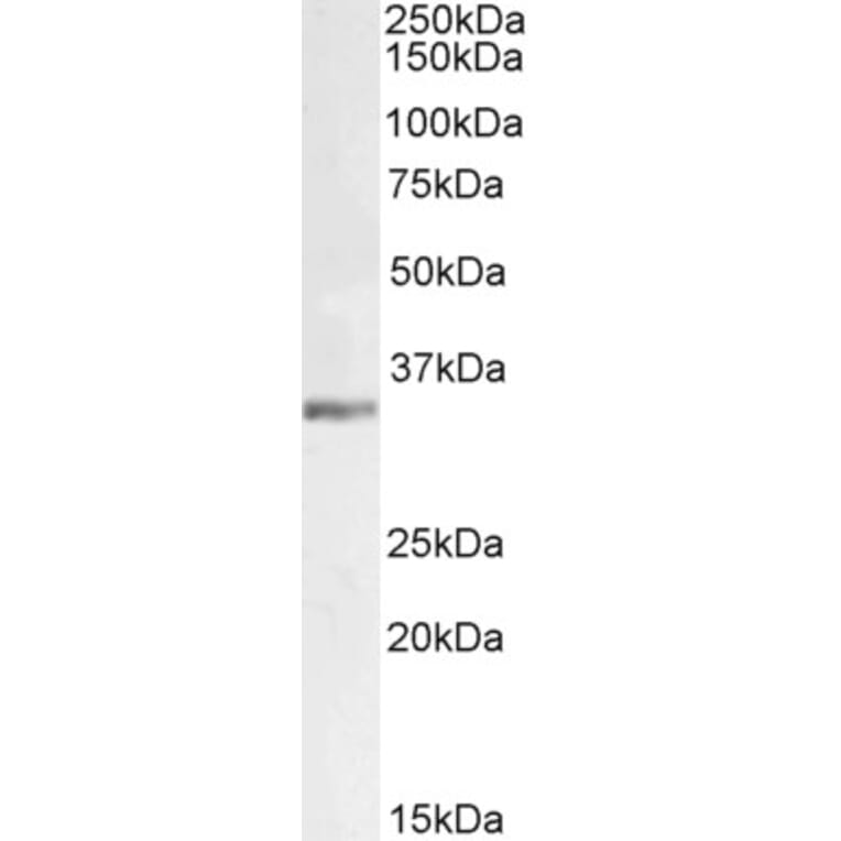 Western Blot - Anti-LDH-C Antibody (A83731) - Antibodies.com