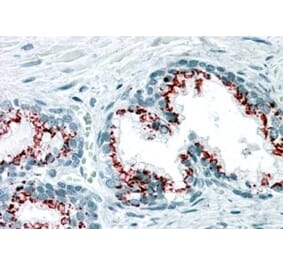 Immunohistochemistry - Anti-GOLPH2 Antibody (A83732) - Antibodies.com