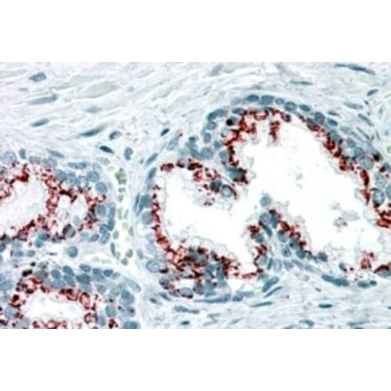 Immunohistochemistry - Anti-GOLPH2 Antibody (A83732) - Antibodies.com