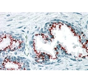 Immunohistochemistry - Anti-GOLM1 Antibody (A83732) - Antibodies.com