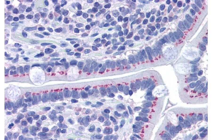 Immunohistochemistry - Anti-GOLPH2 Antibody (A83732) - Antibodies.com