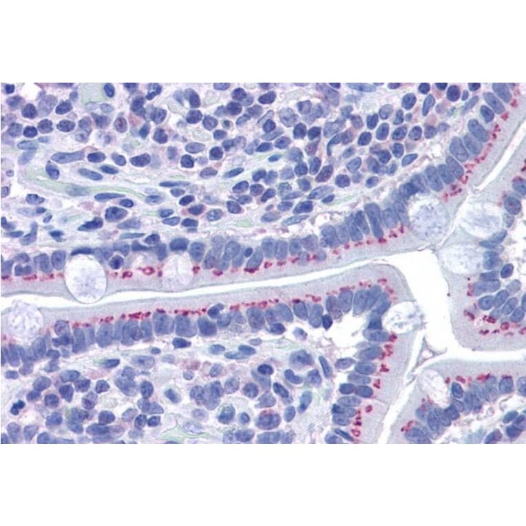 Immunohistochemistry - Anti-GOLPH2 Antibody (A83732) - Antibodies.com