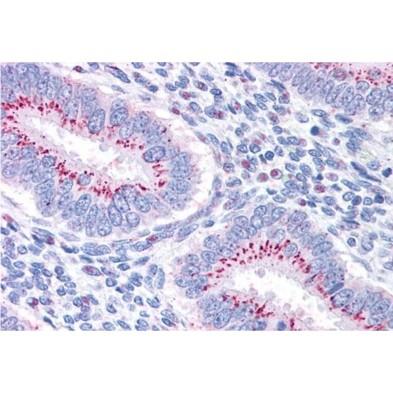 Immunohistochemistry - Anti-GOLPH2 Antibody (A83732) - Antibodies.com