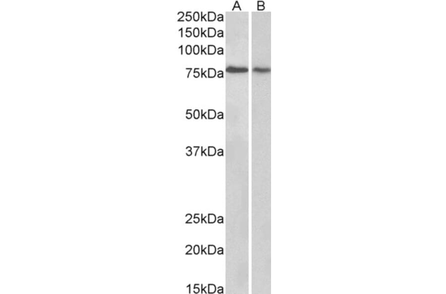 Western Blot - Anti-TRIM3 Antibody (A83733) - Antibodies.com