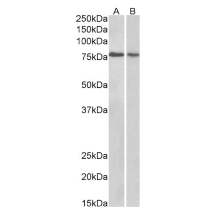 Western Blot - Anti-TRIM3 Antibody (A83733) - Antibodies.com