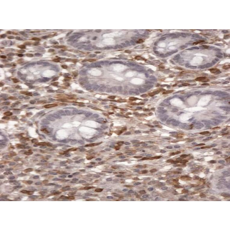 Immunohistochemistry - Anti-S100A4 Antibody (A83734) - Antibodies.com