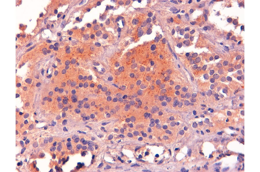 Immunohistochemistry - Anti-POMC Antibody (A83735) - Antibodies.com
