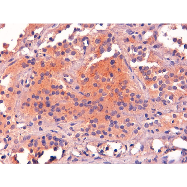 Immunohistochemistry - Anti-POMC Antibody (A83735) - Antibodies.com