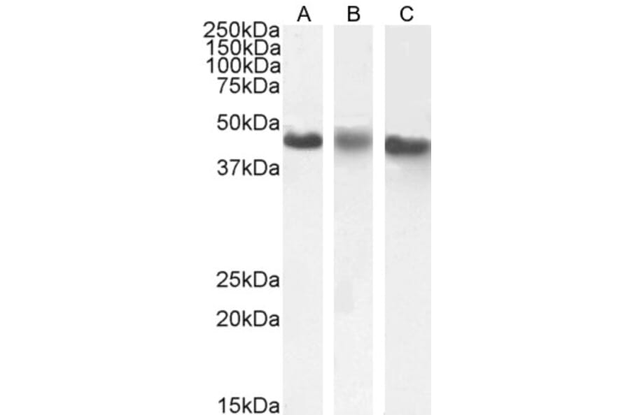 Western Blot - Anti-CK1 epsilon Antibody (A83740) - Antibodies.com
