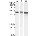 Western Blot - Anti-CK1 epsilon Antibody (A83740) - Antibodies.com