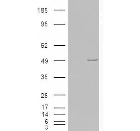 Western Blot - Anti-CSNK1E Antibody (A83740) - Antibodies.com
