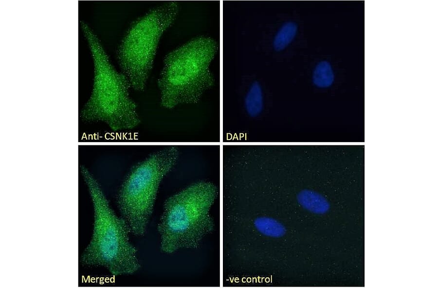 Immunofluorescence - Anti-CK1 epsilon Antibody (A83740) - Antibodies.com