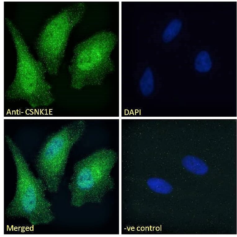 Immunofluorescence - Anti-CK1 epsilon Antibody (A83740) - Antibodies.com