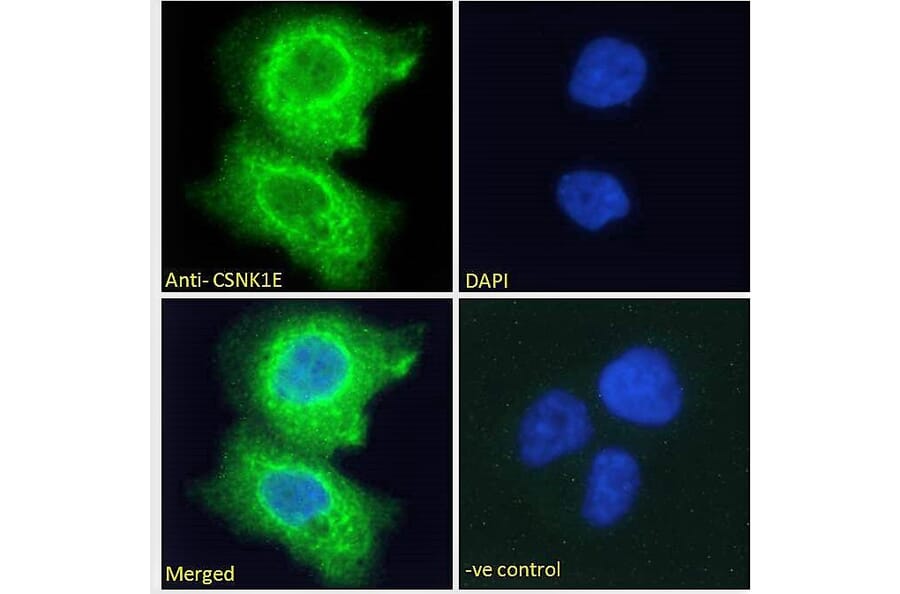 Immunofluorescence - Anti-CK1 epsilon Antibody (A83740) - Antibodies.com