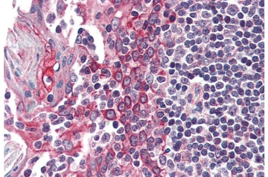Immunohistochemistry - Anti-CK1 epsilon Antibody (A83740) - Antibodies.com