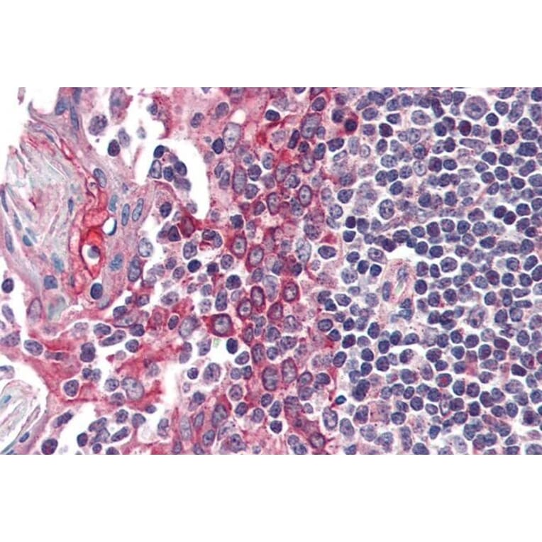 Immunohistochemistry - Anti-CK1 epsilon Antibody (A83740) - Antibodies.com