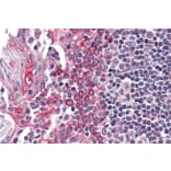 Immunohistochemistry - Anti-CK1 epsilon Antibody (A83740) - Antibodies.com
