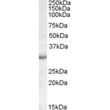 Western Blot - Anti-RAB23 Antibody (A83743) - Antibodies.com