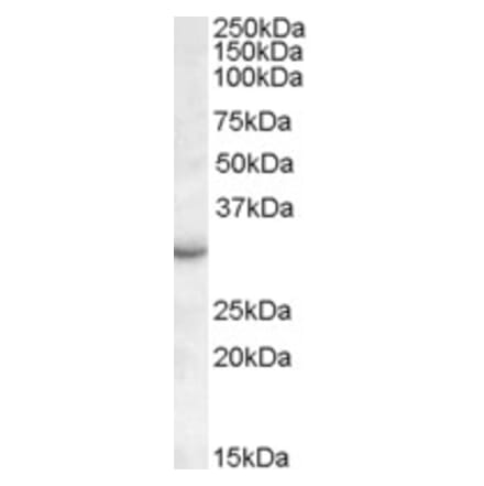 Western Blot - Anti-RAB23 Antibody (A83743) - Antibodies.com