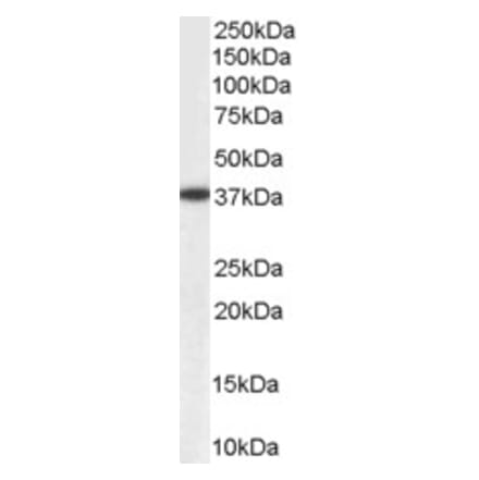 Western Blot - Anti-AKR1A1 Antibody (A83744) - Antibodies.com