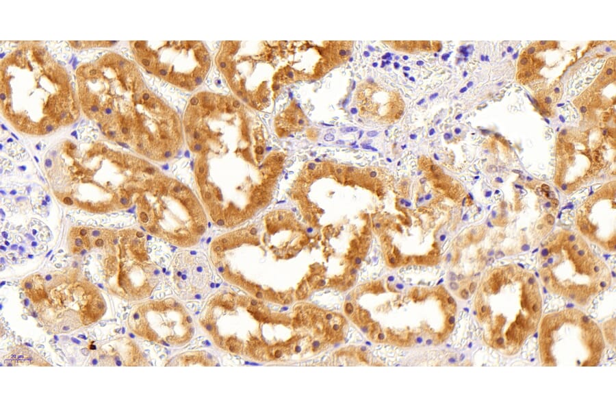 Immunohistochemistry - Anti-AKR1A1 Antibody (A83744) - Antibodies.com
