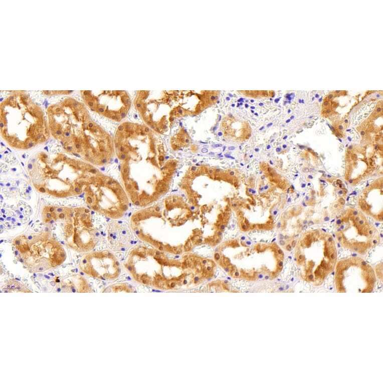 Immunohistochemistry - Anti-AKR1A1 Antibody (A83744) - Antibodies.com