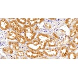 Immunohistochemistry - Anti-AKR1A1 Antibody (A83744) - Antibodies.com