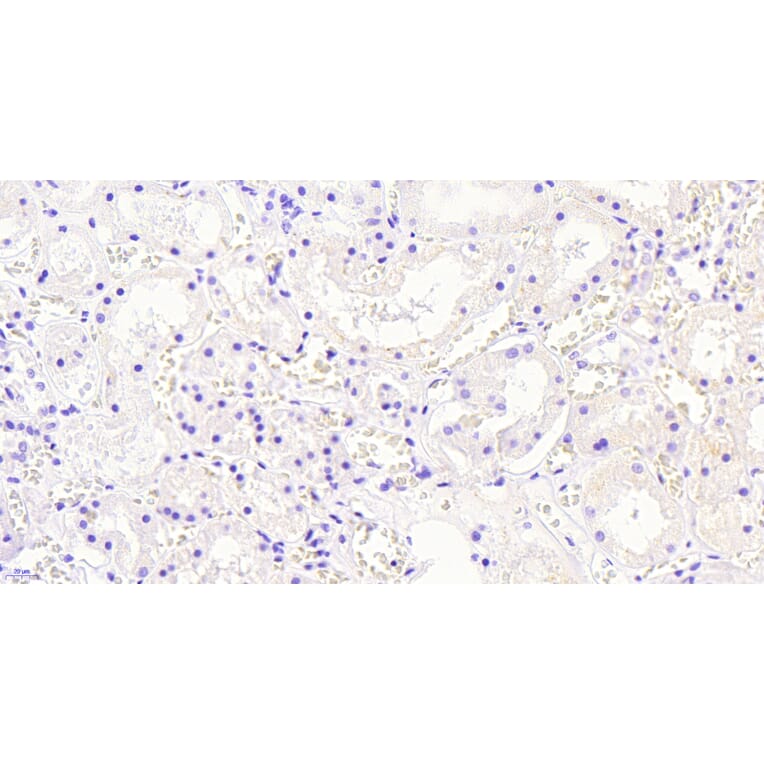 Immunohistochemistry - Anti-AKR1A1 Antibody (A83744) - Antibodies.com