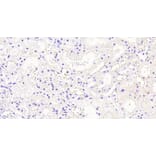 Immunohistochemistry - Anti-AKR1A1 Antibody (A83744) - Antibodies.com