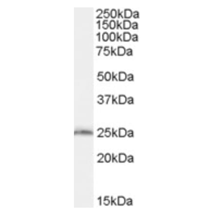 Western Blot - Anti-SAR1B Antibody (A83745) - Antibodies.com