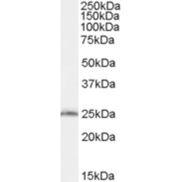 Western Blot - Anti-SAR1B Antibody (A83745) - Antibodies.com