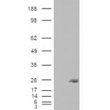 Western Blot - Anti-SAR1B Antibody (A83745) - Antibodies.com