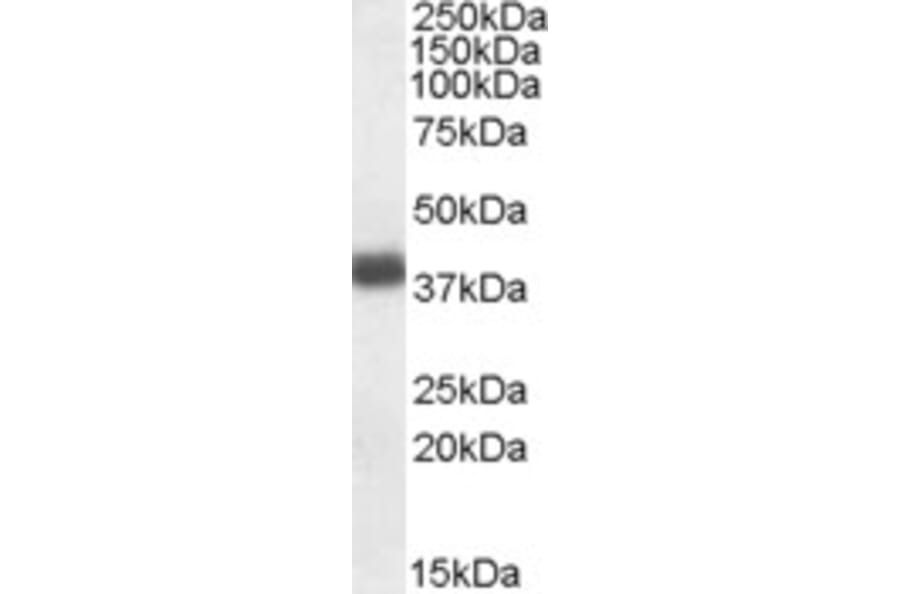 Western Blot - Anti-APOL2 Antibody (A83746) - Antibodies.com