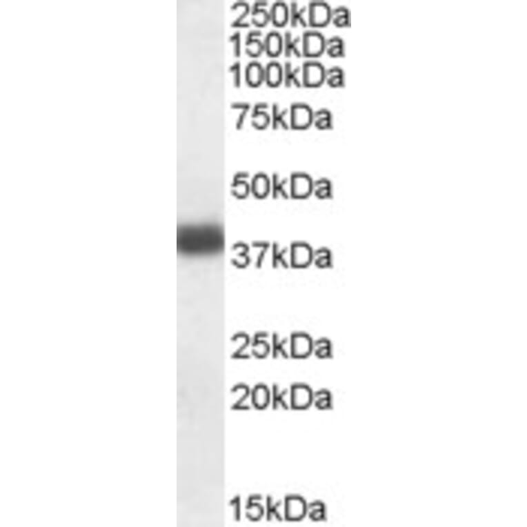 Western Blot - Anti-APOL2 Antibody (A83746) - Antibodies.com