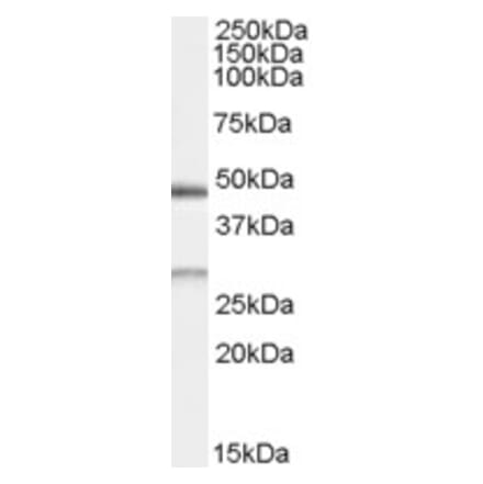 Western Blot - Anti-BNIP1 Antibody (A83748) - Antibodies.com