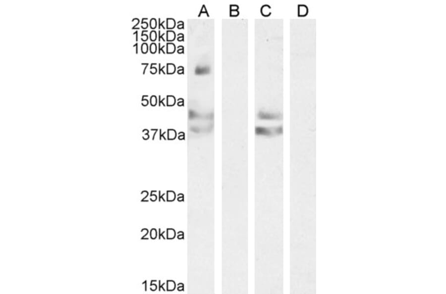 Western Blot - Anti-Angiotensin II Type 1 Receptor Antibody (A83749) - Antibodies.com