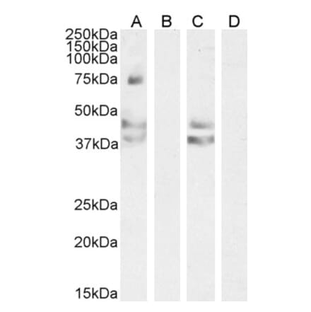 Western Blot - Anti-Angiotensin II Type 1 Receptor Antibody (A83749) - Antibodies.com