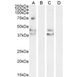 Western Blot - Anti-Angiotensin II Type 1 Receptor Antibody (A83749) - Antibodies.com
