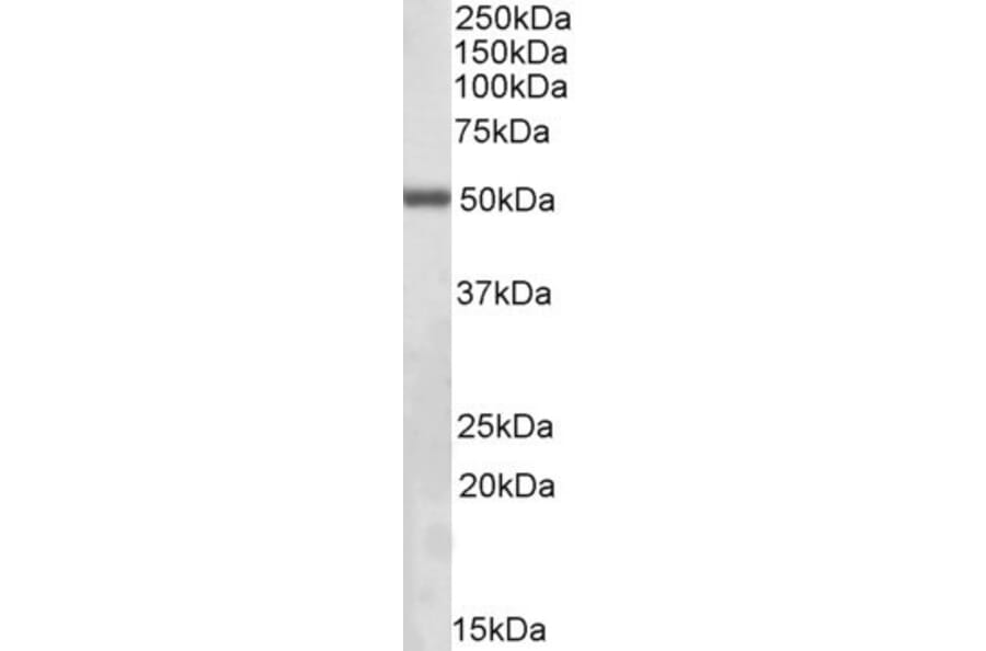 Western Blot - Anti-Integrin Linked ILK Antibody (A83751) - Antibodies.com