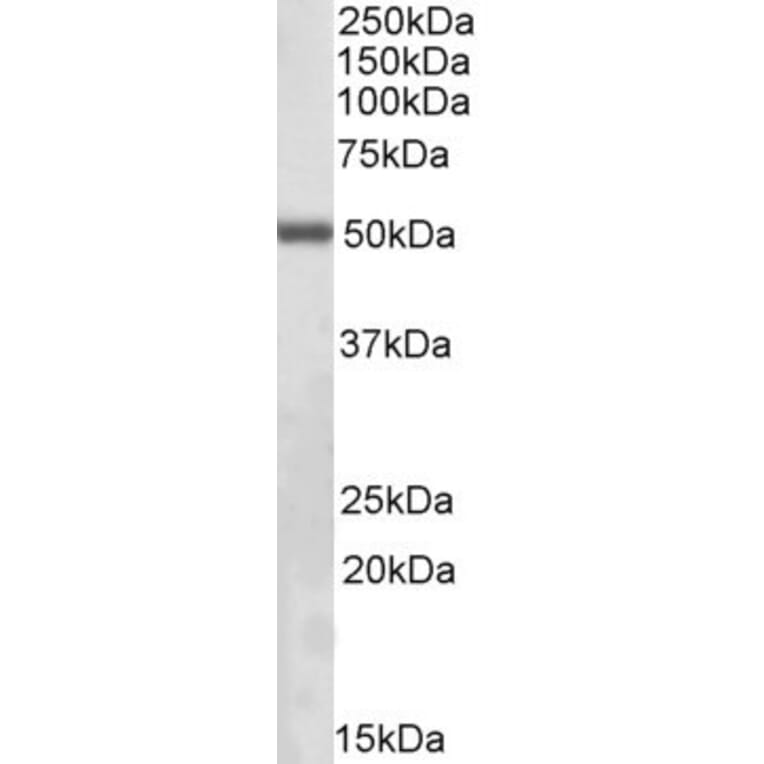 Western Blot - Anti-Integrin Linked ILK Antibody (A83751) - Antibodies.com