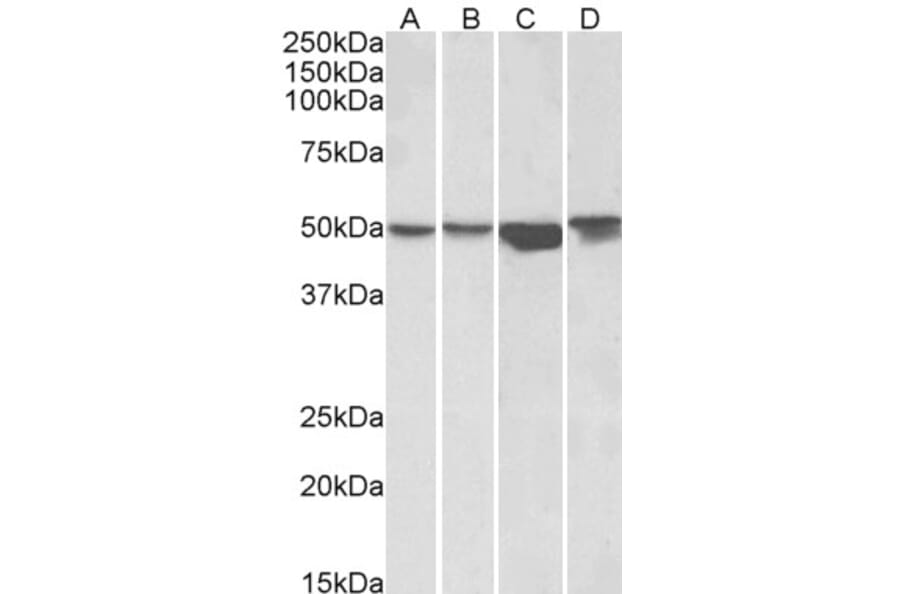 Western Blot - Anti-Integrin Linked ILK Antibody (A83751) - Antibodies.com
