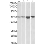 Western Blot - Anti-Integrin Linked ILK Antibody (A83751) - Antibodies.com