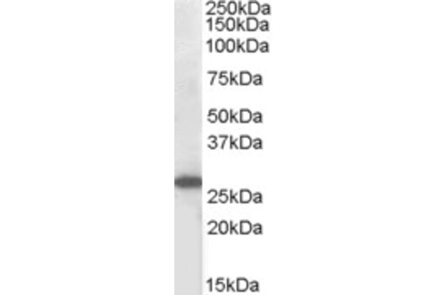 Western Blot - Anti-SOCS3 Antibody (A83755) - Antibodies.com