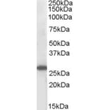 Western Blot - Anti-SOCS3 Antibody (A83755) - Antibodies.com