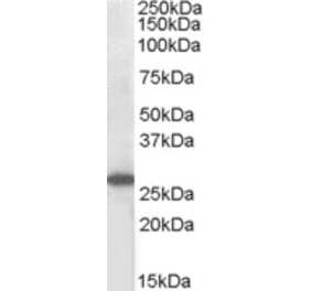 Western Blot - Anti-SOCS3 Antibody (A83755) - Antibodies.com