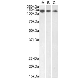 Western Blot - Anti-DDB1 Antibody (A83757) - Antibodies.com