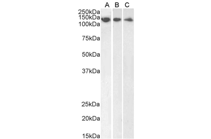 Western Blot - Anti-DDB1 Antibody (A83757) - Antibodies.com