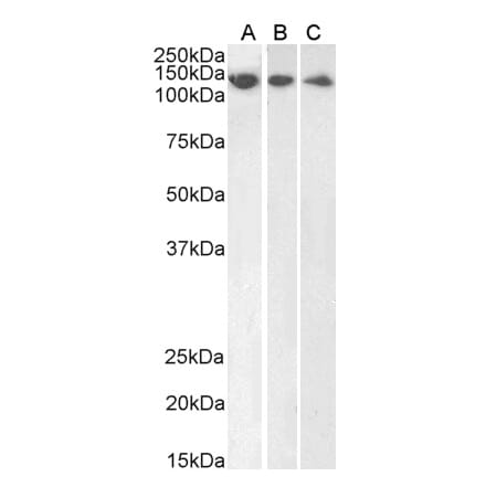 Western Blot - Anti-DDB1 Antibody (A83757) - Antibodies.com